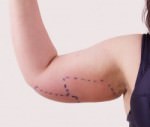 Exilis