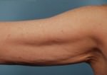 Exilis