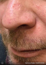 Nose