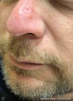 Nose