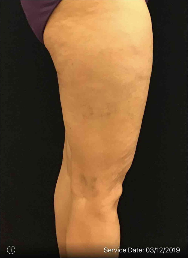 MiniFX