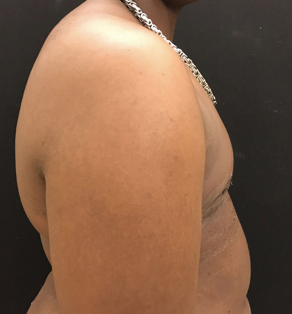 Transgender