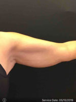 MiniFX