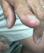 Urgent Care Surgery