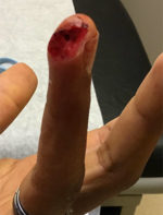 Urgent Care Surgery