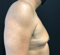 Body