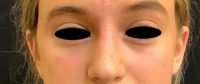 Nose