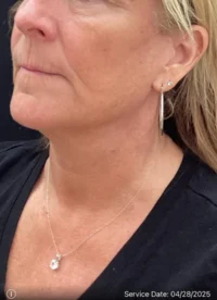 Nouveau Lift