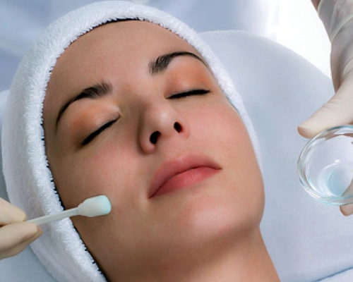 Chemical Peels